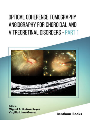 cover image of Optical Coherence Tomography Angiography for Choroidal and Vitreoretinal Disorders, Part 1